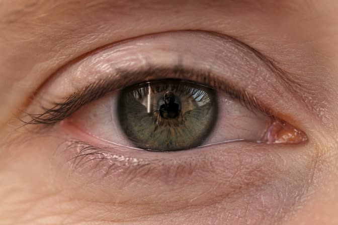 Scene: Eye1